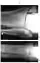 Fig. 34 - Intramedullary fracture fixation devices and methods