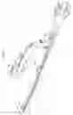 Fig. 42 - Intramedullary fracture fixation devices and methods
