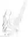 Fig. 44 - Intramedullary fracture fixation devices and methods