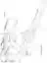 Fig. 45 - Intramedullary fracture fixation devices and methods