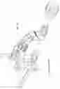 Fig. 46 - Intramedullary fracture fixation devices and methods