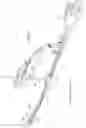 Fig. 47 - Intramedullary fracture fixation devices and methods