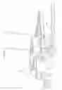 Fig. 57 - Intramedullary fracture fixation devices and methods
