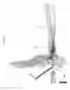 Fig. 75 - Intramedullary fracture fixation devices and methods