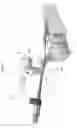 Fig. 78 - Intramedullary fracture fixation devices and methods