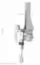 Fig. 80 - Intramedullary fracture fixation devices and methods
