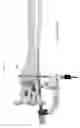 Fig. 87 - Intramedullary fracture fixation devices and methods