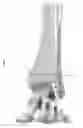 Fig. 88 - Intramedullary fracture fixation devices and methods