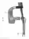 Fig. 93 - Intramedullary fracture fixation devices and methods