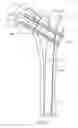 Fig. 22 - Intramedullary rod for pivoting a fastener
