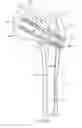 Fig. 24 - Intramedullary rod for pivoting a fastener