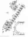 Fig. 11 - Bone fixation system with opposed mounting portions