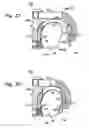 Fig. 15 - Bone fixation system with opposed mounting portions
