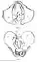 Fig. 07 - Bone screw, and bone fixation system and method