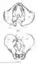 Fig. 08 - Bone screw, and bone fixation system and method