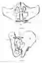 Fig. 09 - Bone screw, and bone fixation system and method