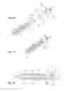 Fig. 08 - Dynamic bone anchor and method of manufacturing the same