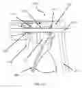Fig. 08 - Material delivery surgical device