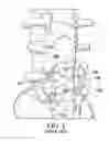 Fig. 02 - Pedicle screw removal tool and method of use
