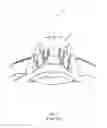 Fig. 02 - Devices and methods for treating a lateral surface of a nasal cavity