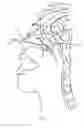 Fig. 04 - Devices and methods for treating a lateral surface of a nasal cavity