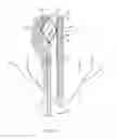 Fig. 15 - Devices and methods for treating a lateral surface of a nasal cavity