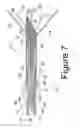 Fig. 07 - ANCHORED RF ABLATION DEVICE FOR THE DESTRUCTION OF TISSUE MASSES