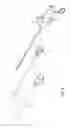 Fig. 06 - Highly maneuverable disposable resectoscope
