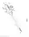 Fig. 09 - Highly maneuverable disposable resectoscope