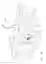 Fig. 48 - Surgical end effector jaw and electrode configurations