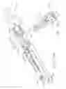 Fig. 80 - Surgical end effector jaw and electrode configurations