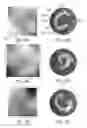 Fig. 07 - Lesion assessment by dielectric property analysis