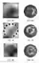 Fig. 08 - Lesion assessment by dielectric property analysis