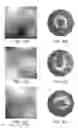 Fig. 09 - Lesion assessment by dielectric property analysis
