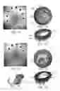Fig. 11 - Lesion assessment by dielectric property analysis