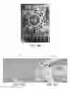 Fig. 13 - Lesion assessment by dielectric property analysis