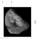 Fig. 09 - System and method for providing a contour video with a 3D surface in a medical navigation system