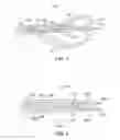 Fig. 06 - Preventing instrument/tissue collisions