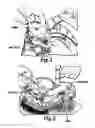 Fig. 02 - METHODS AND APPARATUS FOR CONFORMABLE PROSTHETIC IMPLANTS