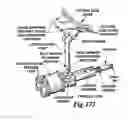 Fig. 35 - METHODS AND APPARATUS FOR CONFORMABLE PROSTHETIC IMPLANTS