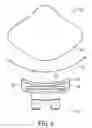 Fig. 07 - Orthodontic brackets for deciduous teeth