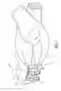Fig. 08 - Orthodontic brackets for deciduous teeth
