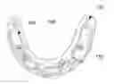 Fig. 01 - Dental prostheses