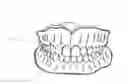Fig. 01 - Apparatus and methods of making denture devices