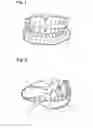 Fig. 02 - Apparatus and methods of making denture devices