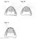 Fig. 06 - Apparatus and methods of making denture devices