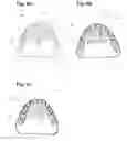 Fig. 07 - Apparatus and methods of making denture devices