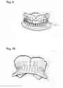 Fig. 08 - Apparatus and methods of making denture devices