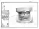 Fig. 09 - Apparatus and methods of making denture devices