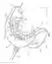Fig. 02 - TEETH WHITENING SYSTEM APPARATUS AND METHOD